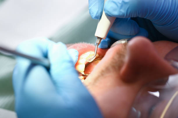 Best Mobile Emergency Dentist in Pontiac, IL