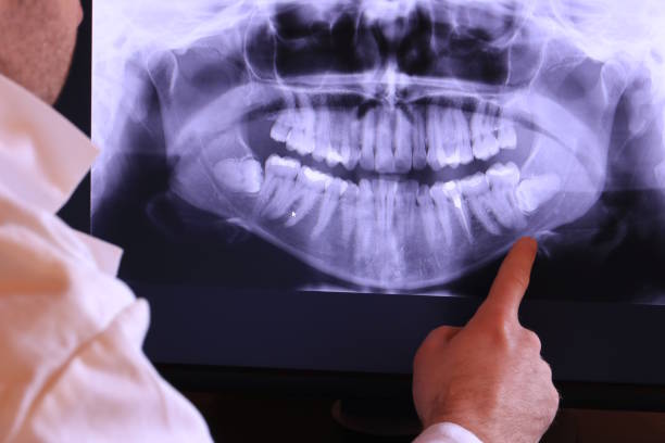 Best Pediatric Emergency Dentist in Pontiac, IL