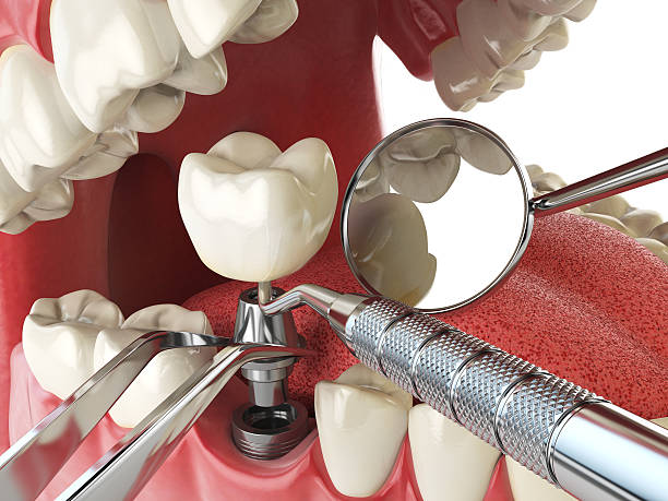 Best Emergency Dentist for Special Needs Patients in Pontiac, IL