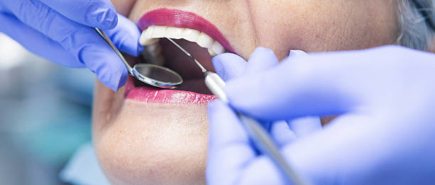 Best Emergency Dentist for Special Needs Patients in Pontiac, IL